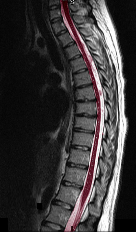 Image Library Bones Spine | BMC Radiology